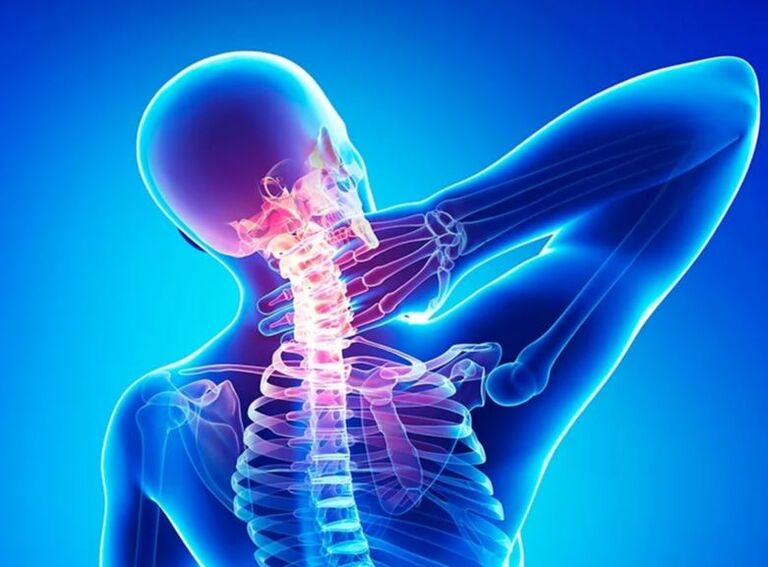 Osteochondrosis of the cervical column