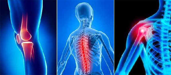 Joint pain in osteoarthritis