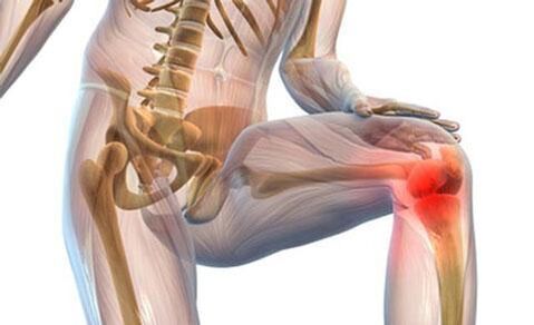 Osteoarthritis of the knee joint