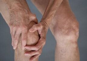 How does knee osteoarthritis manifest